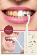 DiscountCap Teeth Whitener and Teeth Eraser Orthodontic Toothbrush Tooth Stain Tartar Remover Oral Care Brush